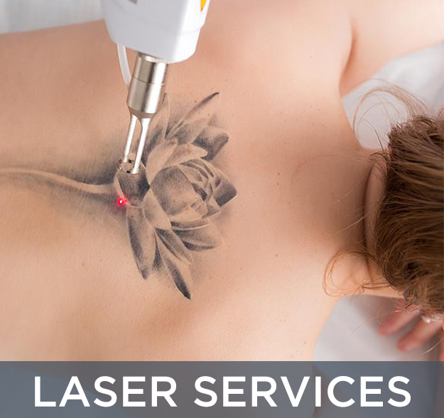 laser services indianapolis